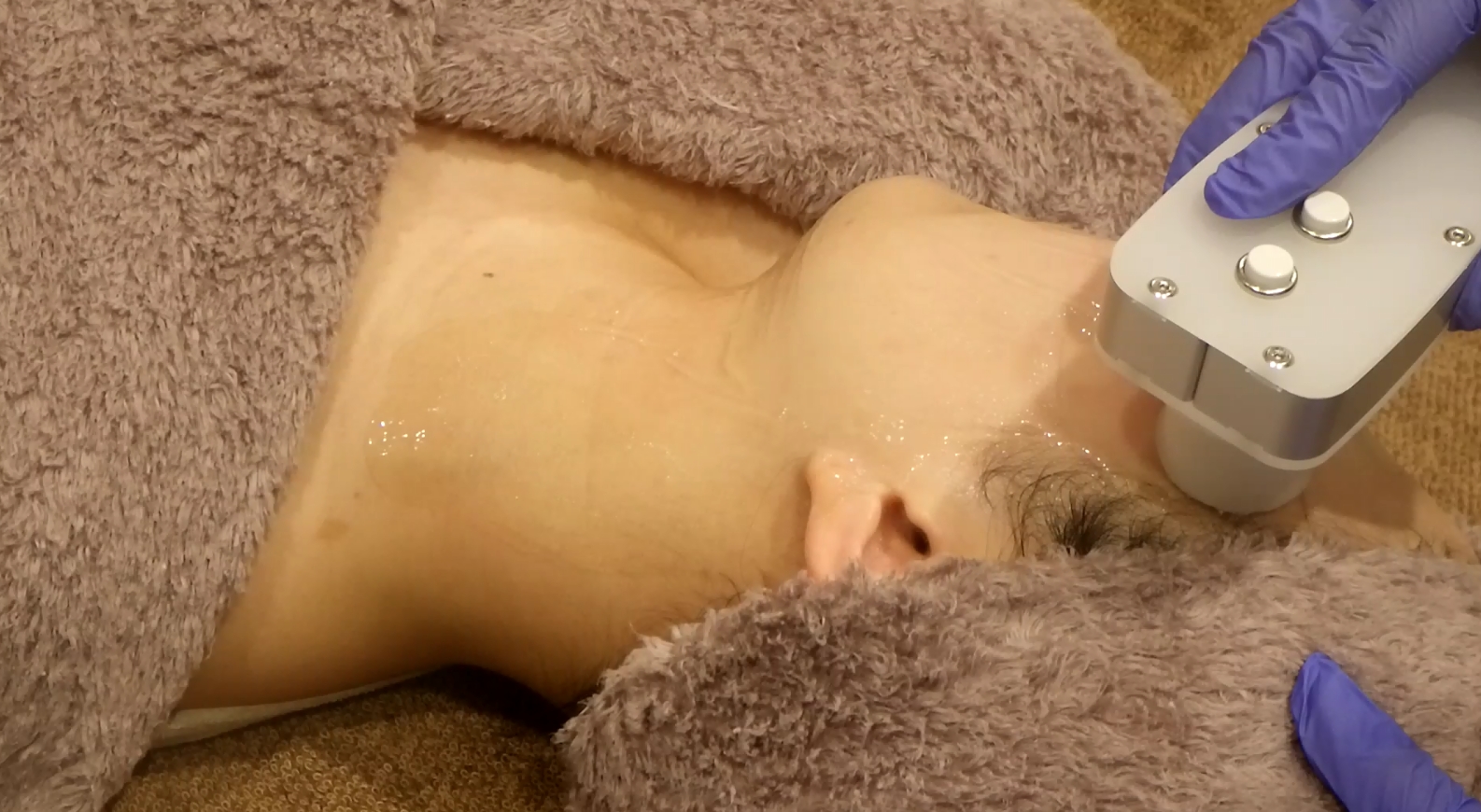 エレクトロポレーション